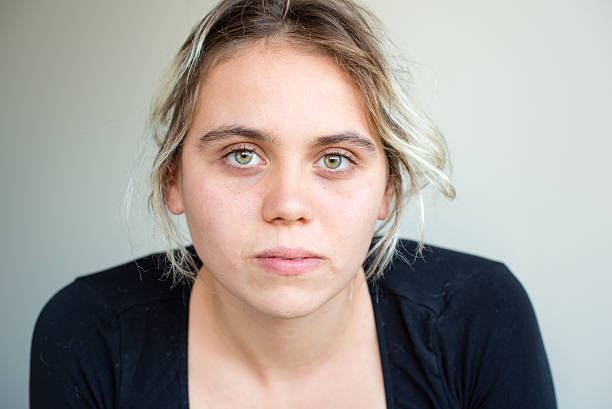 کمبود ویتامین