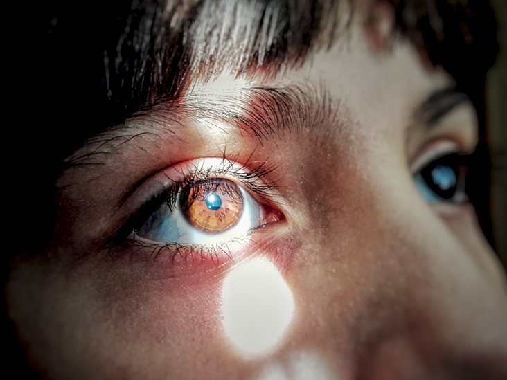 آیا نور خورشید به چشمان شما آسیب می رساند؟