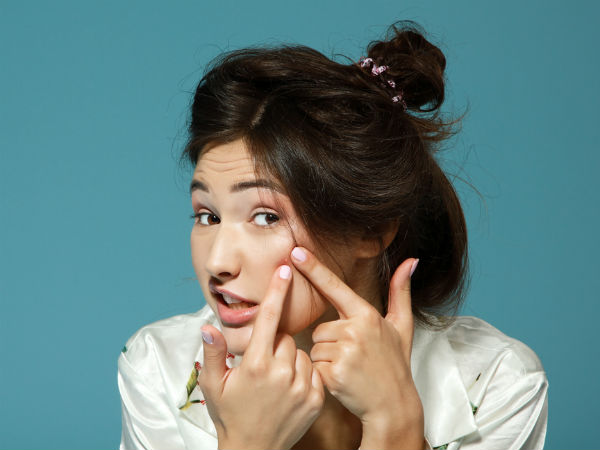 چه چیزی باعث آکنه می شود؟