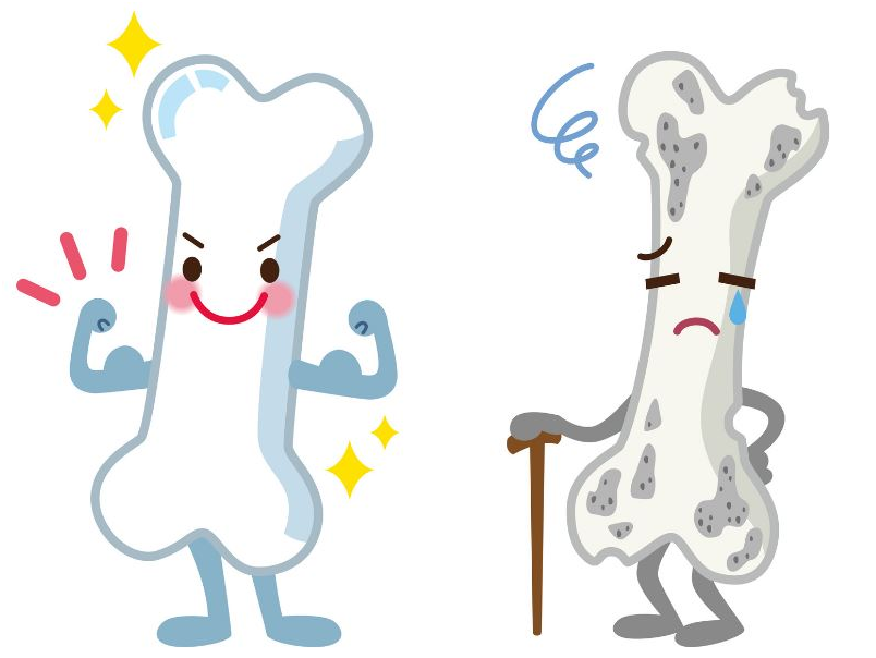 پوکی استخوان