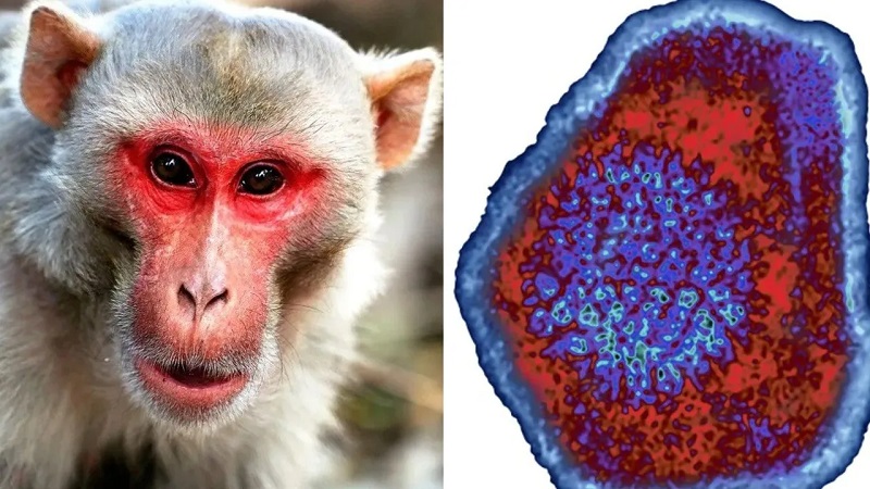 راههای پیشگیری از سرایت آبله میمون