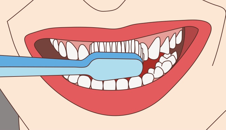 از مسواک هایی با برس نرم استفاده کنید