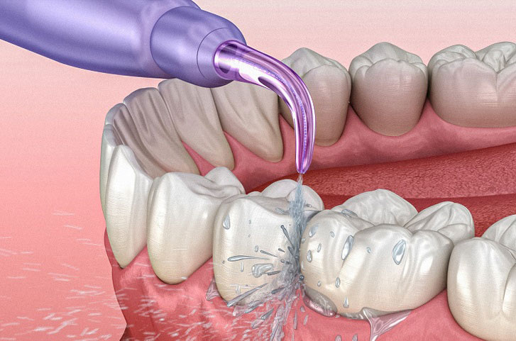 ترفند هایی در مورد مراقبت از دندان که اصلا نمی دانستید