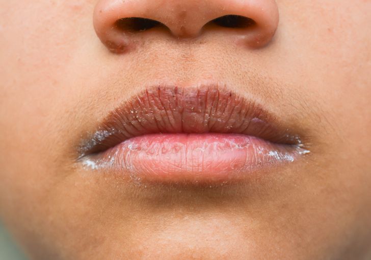 افزایش علائم کم آبی بدن