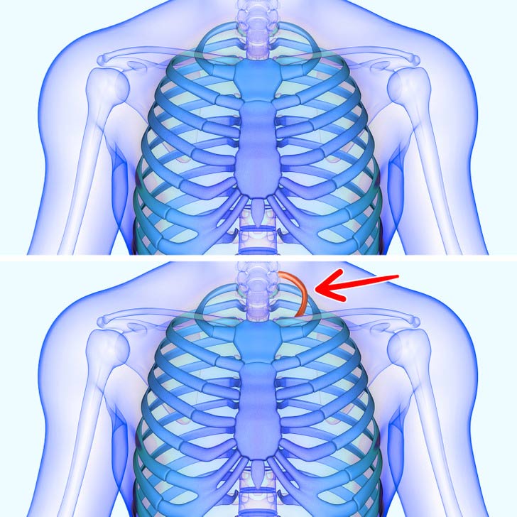 داشتن دنده اضافی