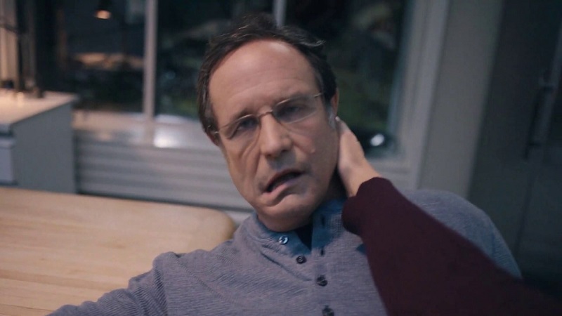 فلج شدن صورت