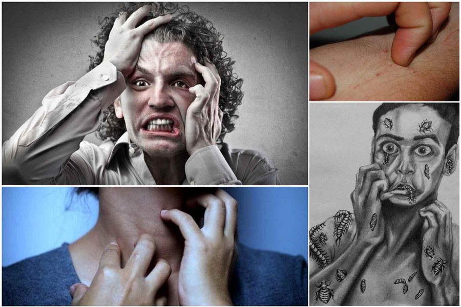 سندروم اکبوم