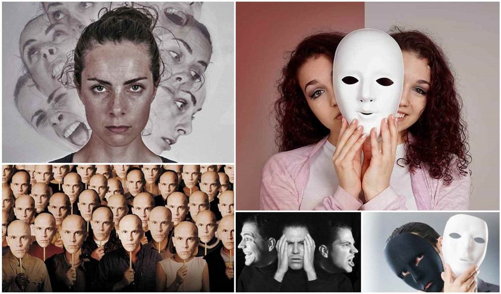 سندروم فرگولی