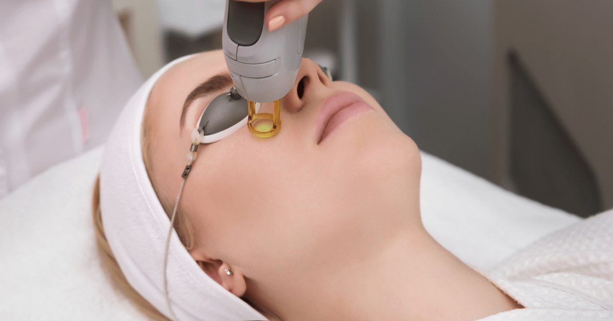 لیزر موهای بدن