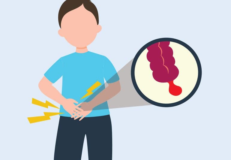 درد آپاندیس