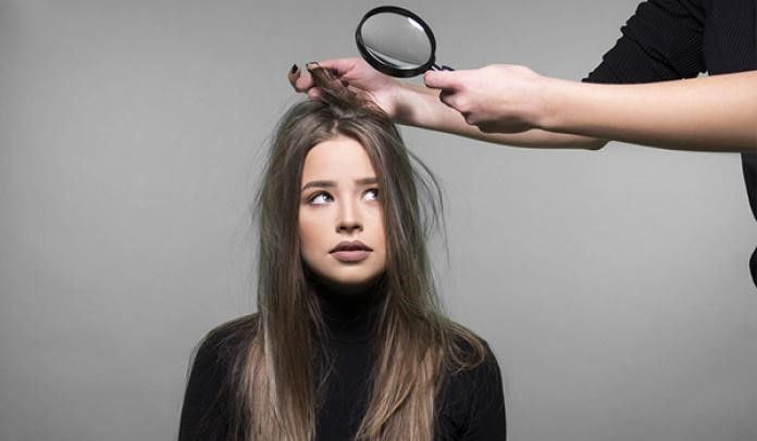 17 روش برای خلاص شدن از موی چرب