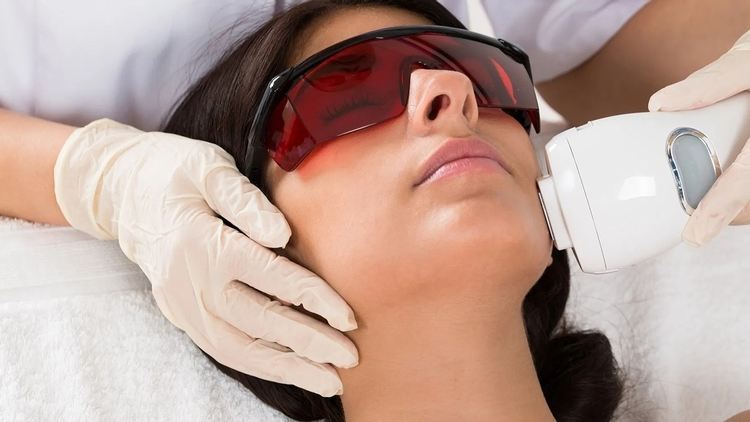 لیزر موهای زائد