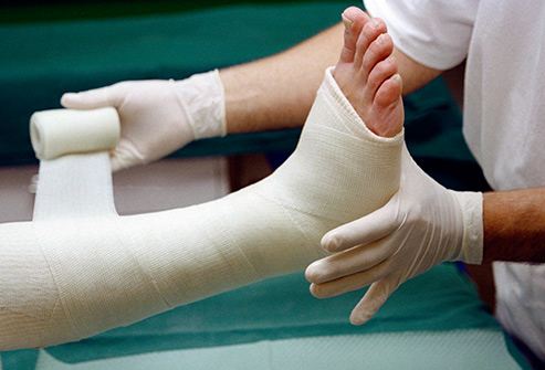 شکستگی استخوان ها