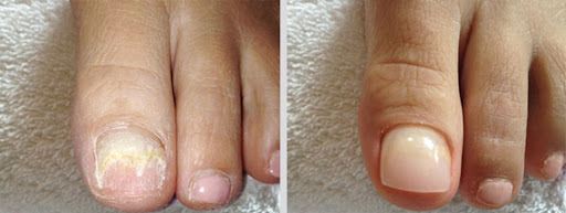 بیماری های عفونی