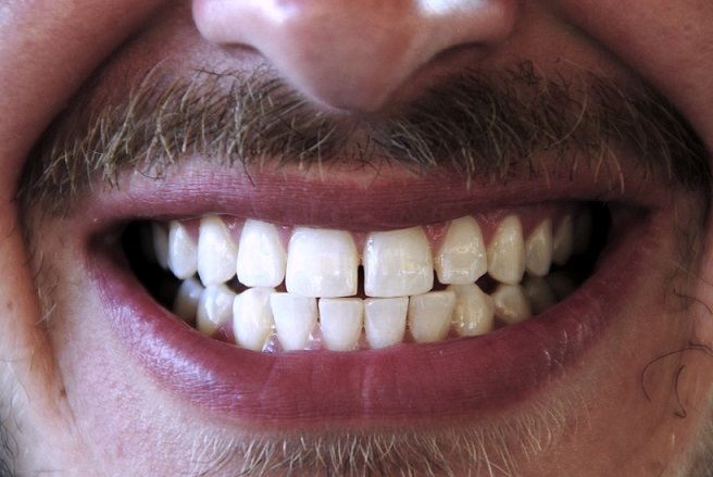 دندان قروچه