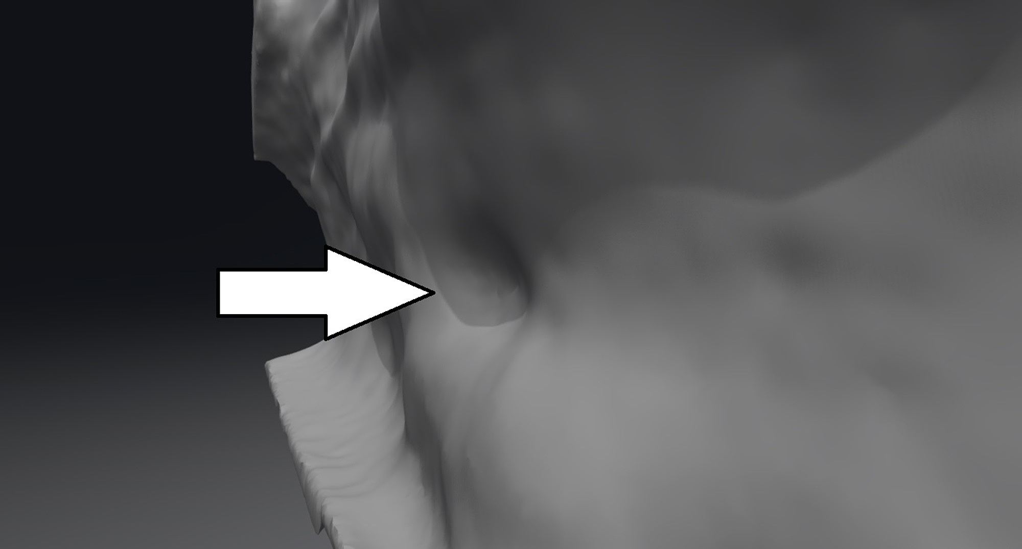 ارگان ژاکوبسون