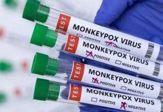 شناسایی ۱۰ مورد مشکوک به آبله میمونی در کشور تایید نشد/ ضرورتی برای تزریق واکسن نیست