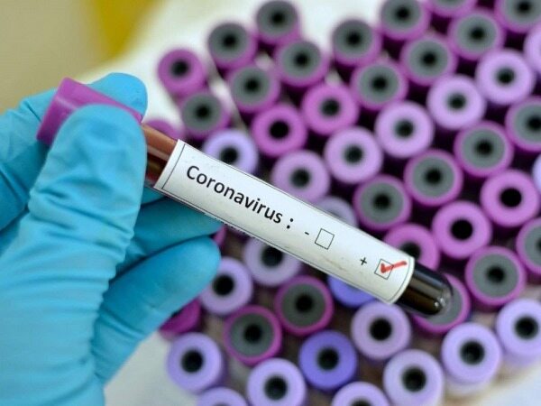 داروی ویروس «کرونا» وارد چین شد