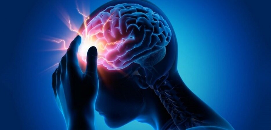 سکته مغزی دومین عامل مرگ ایرانی‌ها/زمان طلایی درمان سکته مغزی