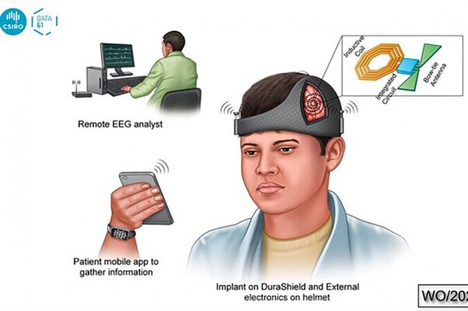 ساخت کلاهی هوشمند که از تشنج مغزی بعد از جراحی جلوگیری می‌کند