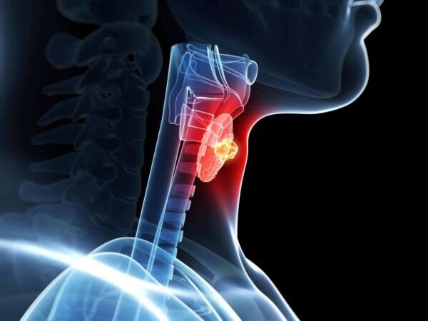 آیا کم کاری تیروئید باعث سقط جنین میشود؟