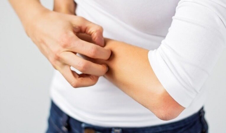 جوش های بازو و کمر درمان می شوند؟