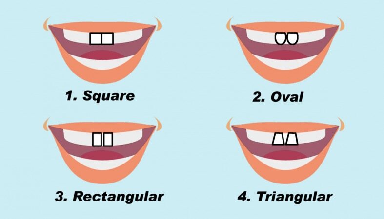 شکل دندان هایتان در مورد شخصیت شما چه میگویند ؟!