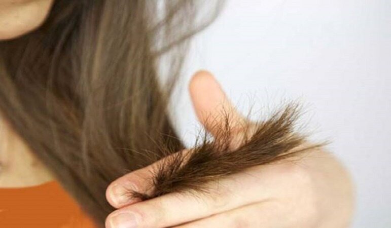 با این 5 روش برای همیشه با موخوره موهای خود خداحافظی کنید