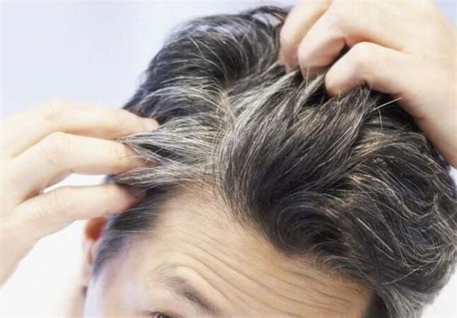 ۹ ماده غذایی که به پیشگیری از سفیدی مو‌ کمک می‌کنند