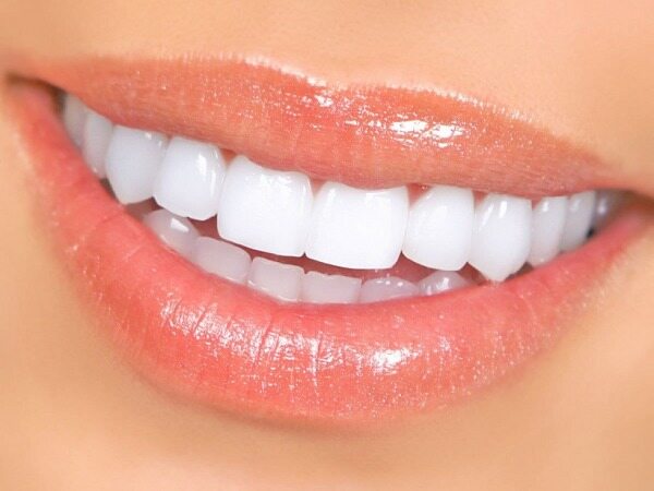 آثار مخرب سفید کردن دندان