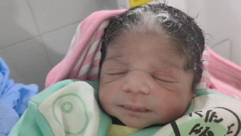 تولد نوزادی بدون پوست با موهای سفید در مصر! + عکس