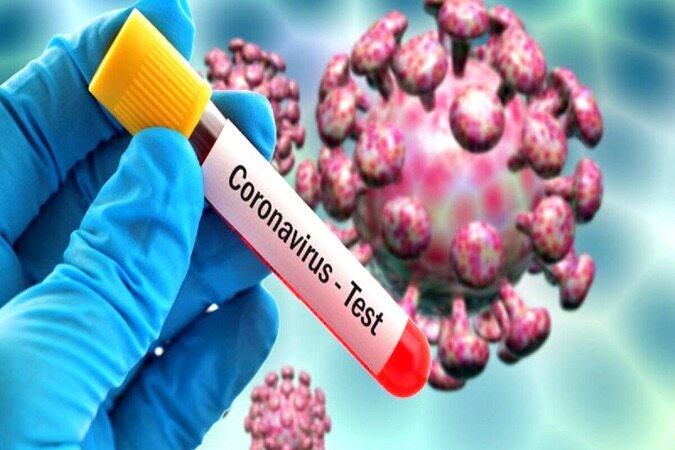 شروط انجام تست اُمیکرون برای افراد علامت‌دار