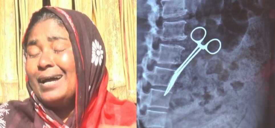 خارج کردن قیچی از شکم یک زن پس از ۲۰ سال!+عکس