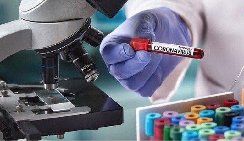 فهرست آزمایشگاه‌های تشخیص کووید ۱۹ اعلام شد