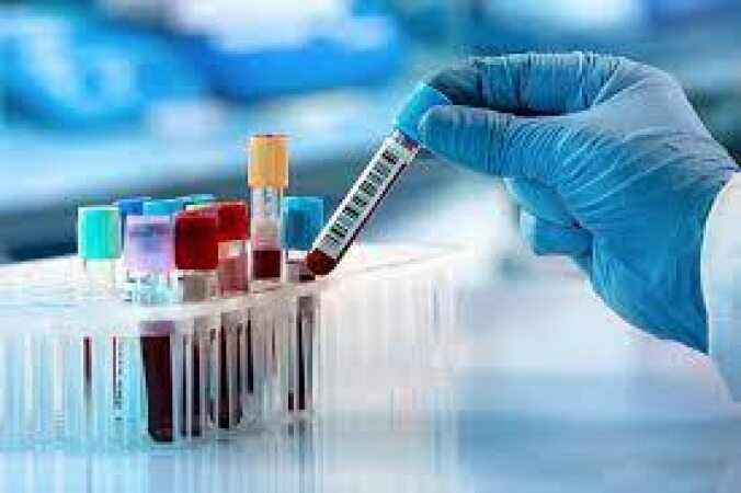پاسخ وزارت بهداشت به اظهاراتی درباره کمبود و کیفیت پایین لوله‌ نمونه‌گیری در آزمایشگاه‌ها