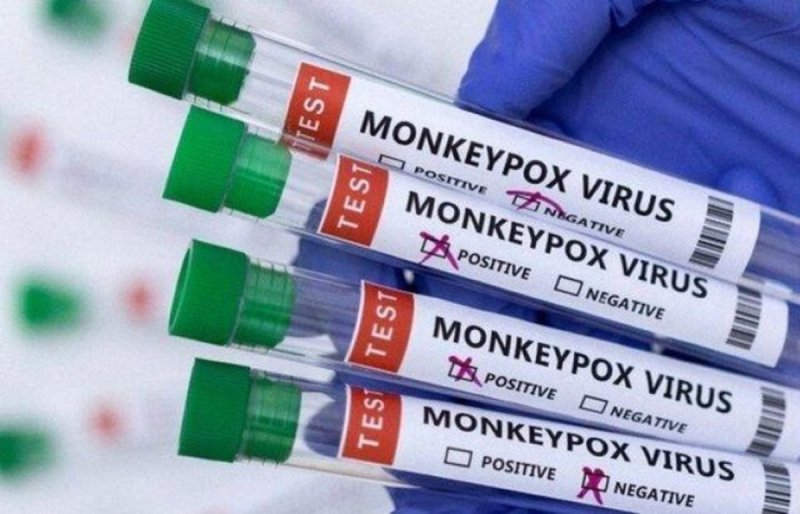 ژاپن واکسن آبله را برای پیشگیری از آبله میمونی تایید کرد