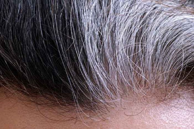 جلوگیری از سفید شدن مو با گیاهی فوق العاده