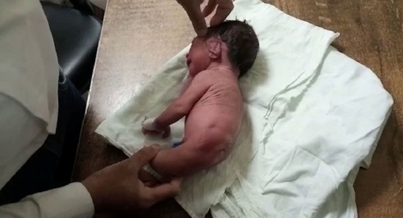 تولد نوزاد عجیب الخلقه شاخ دار! + تصاویر