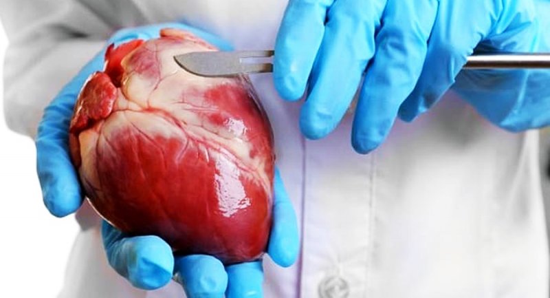 جراحی قلب 900 هزارتومان، جراحی بینی 20 میلیون تومان / اینجا ایران است!
