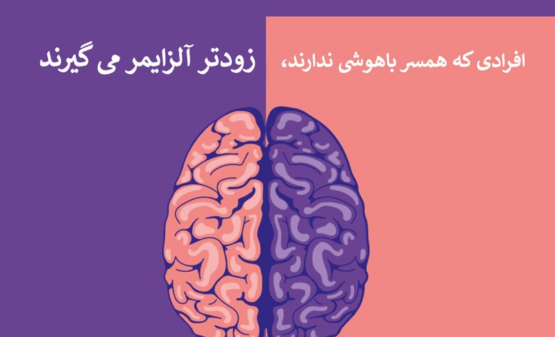 آلزایمر