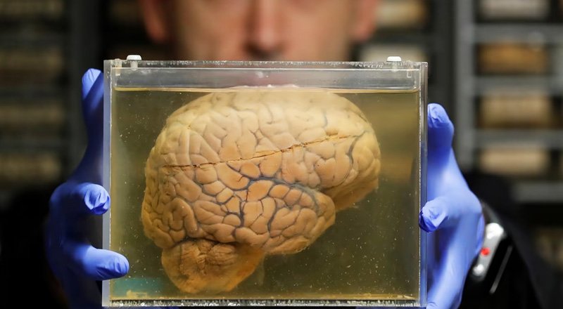 شایعه وحشتناکی که حقیقت داشت؛ نگهداری ۱۰هزار مغز انسان در یک زیر زمین + تصاویر