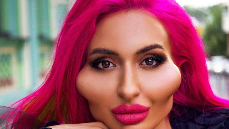 این زن بزرگترین گونه های جهان را دارد + تصاویر حیرت انگیز از قبل و بعد عمل