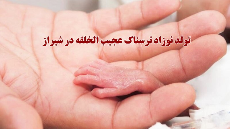 یک نوزاد ترسناک و عجیب الخلقه در شیراز به دنیا آمد! +عکس
