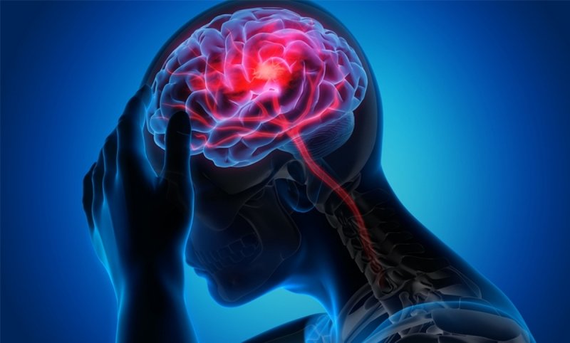 عوامل موثر در بروز سکته مغزی را بشناسید